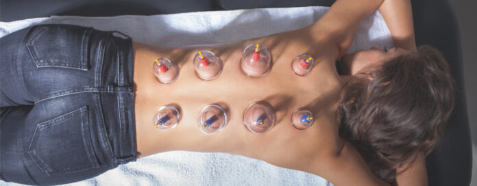 Cupping therapy Melbourne